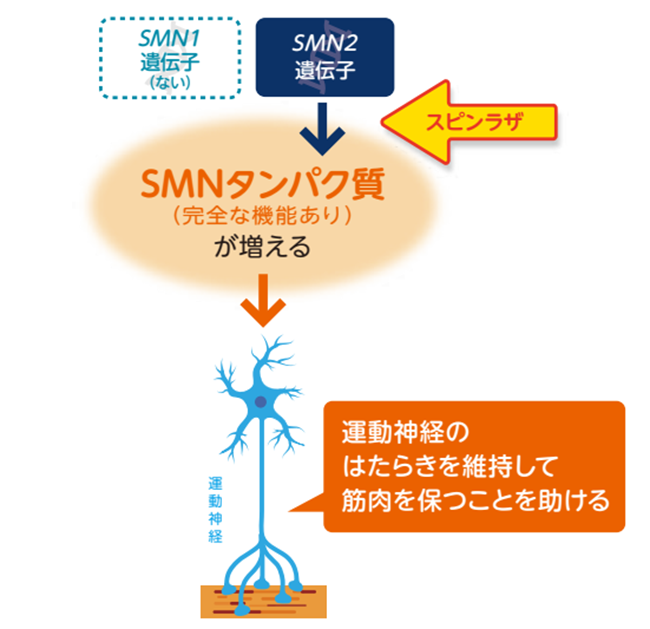 SMAのある人にスピンラザを投与した場合